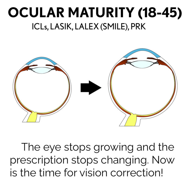 Ocular Maturity